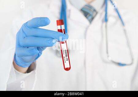 Il medico tiene una provetta. Test del sangue, test positivo del virus corona Foto Stock