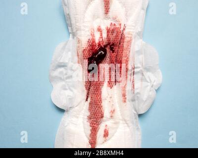 Sintomo di endometriosi, sangue mestruale con coaguli di sangue su un cuscinetto sanitario, immagine ravvicinata Foto Stock