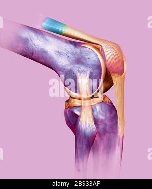 Dal punto di vista medico accurato 3D illustrazione che mostra la dolorosa del ginocchio con evidenziati anteriore e legamento crociato posteriore, menisco, la cartilagine articolare Foto Stock