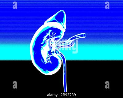 Illustrazione medica che mostra il rene, illustrazione Foto Stock