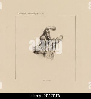 Caricatura ortopedica, n. 4. (MFR 19) (registrata come) | Cartoon ortopedico n° 4 (complesso) Foto Stock