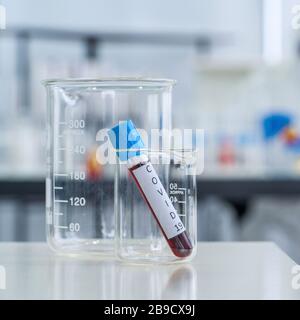 Provette per il prelievo di sangue da 19 pazienti covid su un tavolo bianco da laboratorio. Foto Stock