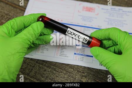 Viersen, Germania - Marzo 22. 2020: Primo piano delle mani isolate con guanti verdi che tengono il flaconcino del campione di sangue con la parola covid-19. Richiesta di test di laboratorio sfocata Foto Stock