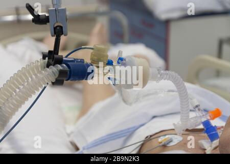 Tubo di collegamento respiratorio, filtro HME e catetere di aspirazione, paziente collegato al ventilatore medico in terapia intensiva in ospedale. Foto Stock