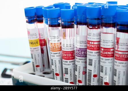 Diversi campioni di sangue infetti fittizi con vari virus su un rack per fiale. Foto Stock