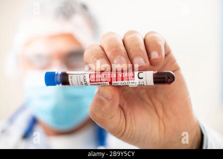Vista di un medico in possesso di un campione di sangue di una provetta fittizia, infettato con virus dell'epatite C. Foto Stock