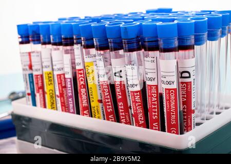 Diversi campioni di sangue infetti fittizi con vari virus su un rack per fiale. Foto Stock