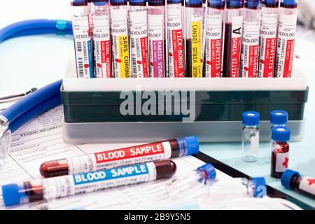 Diversi campioni di sangue infetti fittizi con vari virus su un rack per fiale. Foto Stock