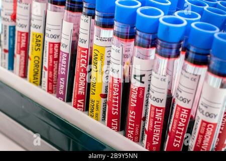 Diversi campioni di sangue infetti fittizi con vari virus su un rack per fiale. Foto Stock
