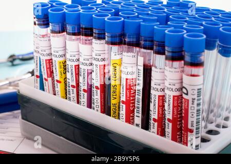 Diversi campioni di sangue infetti fittizi con vari virus su un rack per fiale. Foto Stock