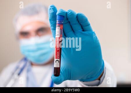 Vista di un medico in possesso di un campione di sangue di una provetta fittizia, infettato con virus dell'epatite C. Foto Stock