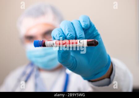 Vista di un medico in possesso di un campione di sangue di una provetta fittizia, infettato con virus dell'epatite C. Foto Stock