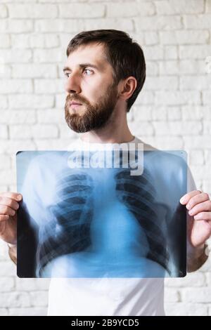 Giovane uomo bearded che tiene film di raggi X di polmoni e cuore davanti al suo petto, sfondo bianco. Orientamento verticale Foto Stock