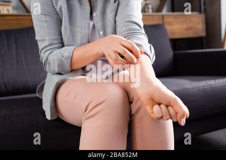 vista tagliata della donna che graffia la mano mentre si siede sul divano Foto Stock