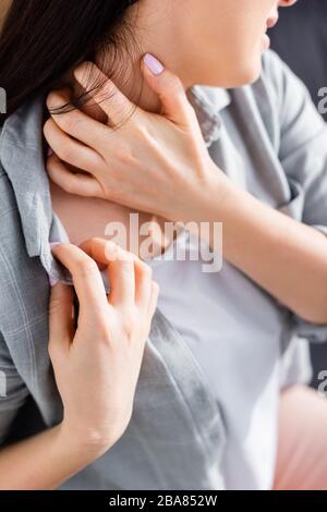 vista tagliata della donna allergica che graffia il collo Foto Stock