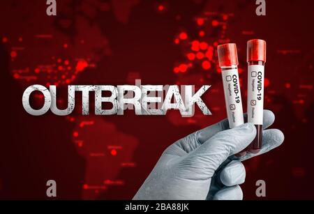 Concetto COVID-19 pandemico: Scienziato che tiene il campione di sangue in provette con risultati positivi del test marcati. Messaggio di epidemia di fronte a Ameri sfocato Foto Stock