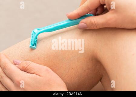 Immagine ravvicinata della donna che tiene il rasoio, rasando la gamba pelosa con folliculite Foto Stock