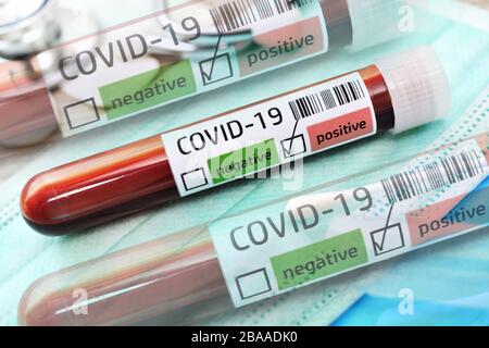 FOTOMONTAGGIO, esami del sangue con risultati positivi di Covid 19, foto simbolica Coronavirus, FOTOMONTAGE, Blutproben mit positivem Covid-19-Befund, Symbolfo Foto Stock