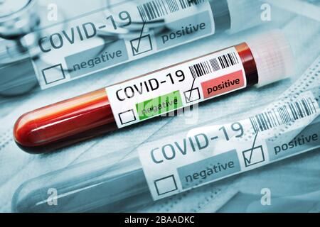 FOTOMONTAGGIO, esami del sangue con risultati positivi di Covid 19, foto simbolica Coronavirus, FOTOMONTAGE, Blutproben mit positivem Covid-19-Befund, Symbolfo Foto Stock