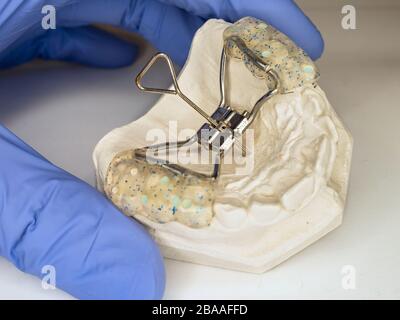 Come impostare le bretelle per i bambini. Test Hyrax Rapid Palatal expander su dentini in gesso copia in laboratorio dentista Foto Stock
