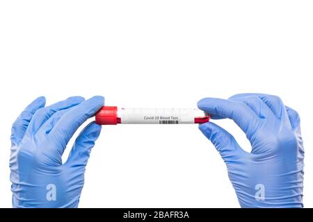 Mani con guanti di un pallone di contenimento per infermiere o virologo con campione di sangue per test con covid19 su fondo bianco isolato Foto Stock