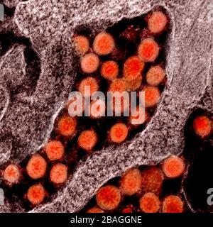 Micrografia elettronica a trasmissione di particelle di virus SARS-cov-2, isolate da un paziente. Immagine acquisita e colore migliorato presso il NIAID Integrated Research Facility (IRF) di Fort Detrick, Maryland. Foto Stock