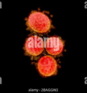 Micrografia elettronica a trasmissione di particelle di virus SARS-cov-2, isolate da un paziente. Immagine acquisita e colore migliorato presso il NIAID Integrated Research Facility (IRF) di Fort Detrick, Maryland. Foto Stock