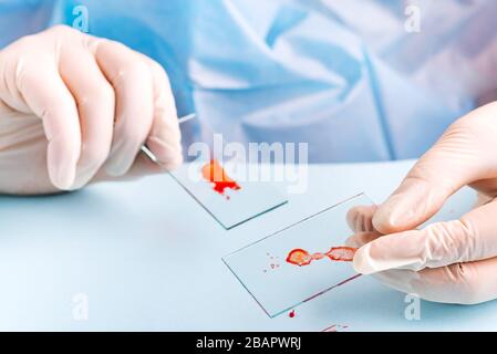 tecnico di laboratorio che gocciola sangue rosso umano sul vetrino per un test antivirus su sfondo blu Foto Stock