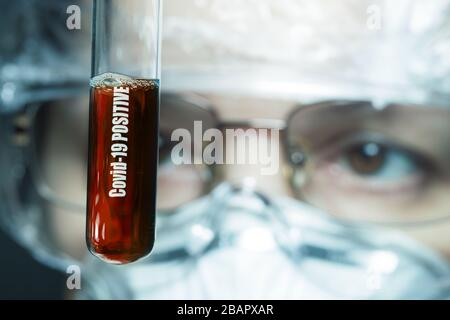 Campione di sangue positivo nella mano dei medici. Messa a fuoco selezionata. Pandemia di coronavirus Foto Stock
