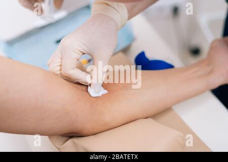 L'infermiere tratta il braccio del paziente con cotone imbevuto di alcool prima di prendere il sangue. Foto Stock
