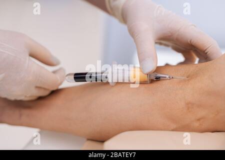 Assistente di laboratorio che raccoglie il campione di sangue dalle vene con capsula sottovuoto. Foto Stock