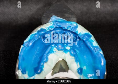 impronta in silicone di denti umani primo piano. produzione di corone dentarie e spine di radice. Foto Stock