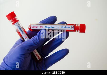 Mano gloved che tiene il risultato positivo del test del sangue per Coronavirus Foto Stock