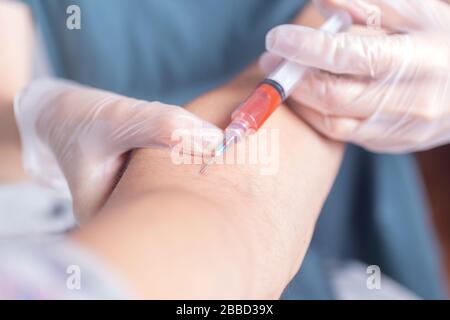 Primo piano delle mani con una siringa che prende il test del sangue dal braccio Foto Stock