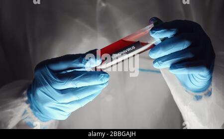 Le mani del medico che tengono la provetta per il vaccino Foto Stock