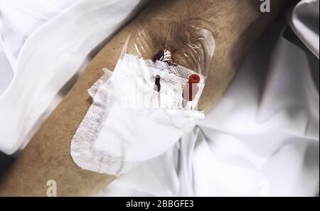 Via endovenosa nel braccio di un paziente ospedaliero, salute e medicina Foto Stock