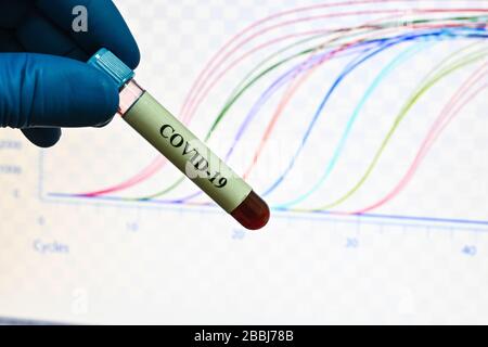 Rilevamento PCR del coronavirus SARS-COV-2. Campione di sangue per la ricerca su COVID-19. Foto Stock