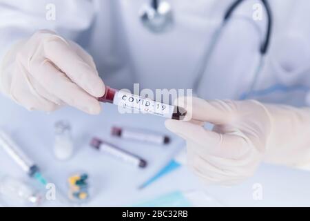 Le mani del medico con guanti protettivi che tengono il sangue di prova di Coronavirus COVID 19. Test antivirus e concetto di ricerca Foto Stock