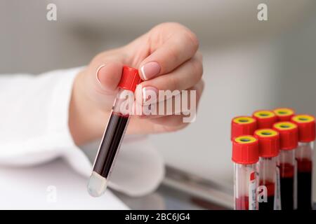 Il medico preleva la provetta di campione di sangue dal vassoio sul tavolo. Foto Stock