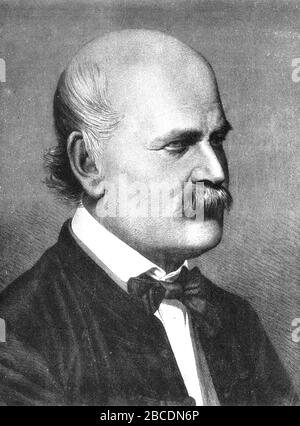 Ignaz Semmelweis, Ignaz Philipp Semmelweis (1818 – 1865) medico e scienziato ungherese, ora noto come un pioniere delle procedure antisettiche Foto Stock