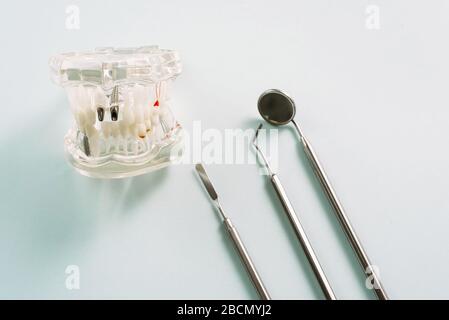 Un modello della mascella con impianti metallici si trova accanto agli strumenti dentali su uno sfondo blu. Foto Stock