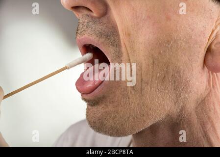 Prelevare un campione di test del virus da una gola Foto Stock
