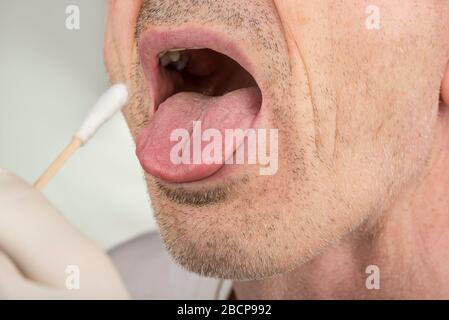 Prelevare un campione di test del virus da una gola Foto Stock