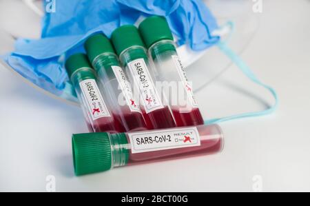 COVID-19 pandemico. Provette per campioni medicali, risultato positivo o negativo del test SARS-cov-2. Focolaio di coronavirus. Laboratorio astratto ancora vita. Centro di test. Foto Stock