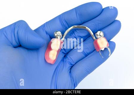 protesi rimovibile concetto. protesi con falso dente. dentiera in mano di un dentista. protesi ad arco con mandibola inferiore rimovibile Foto Stock