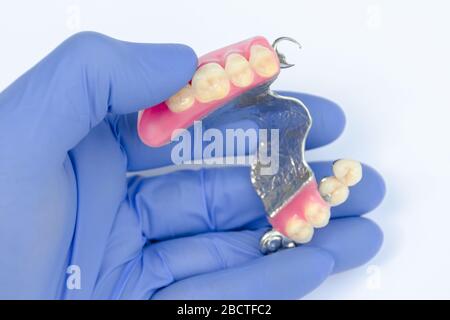 dentiera superiore nelle mani di un dentista. guanto blu. protesi clasp. denti falsi. corone in ceramica-metallo Foto Stock