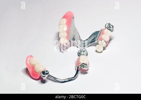 una serie di protesi a gancio rimovibile con corone metalliche-ceramiche di supporto sulle ganasce superiore e inferiore su fondo isolato Foto Stock