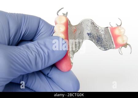 protesi a gancio rimovibile con fissaggio a gancio sulla mascella superiore nelle mani del dentista Foto Stock