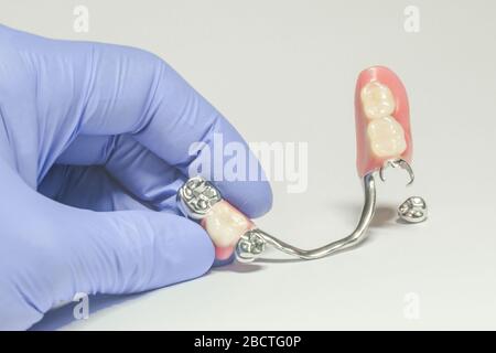 protesi ad arco parziale della mandibola inferiore con corone metalliche nelle mani del dentista Foto Stock