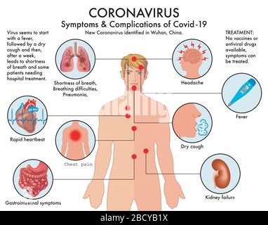 Grafico dei sintomi e delle complicazioni di Coronavirus (Covid-19) con annotazioni. Illustrazione Vettoriale